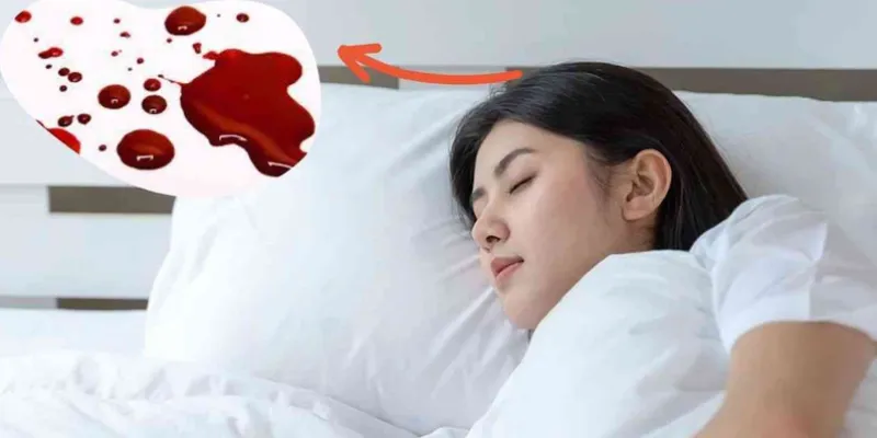 Ý nghĩa những trường hợp mơ thấy máu chảy
